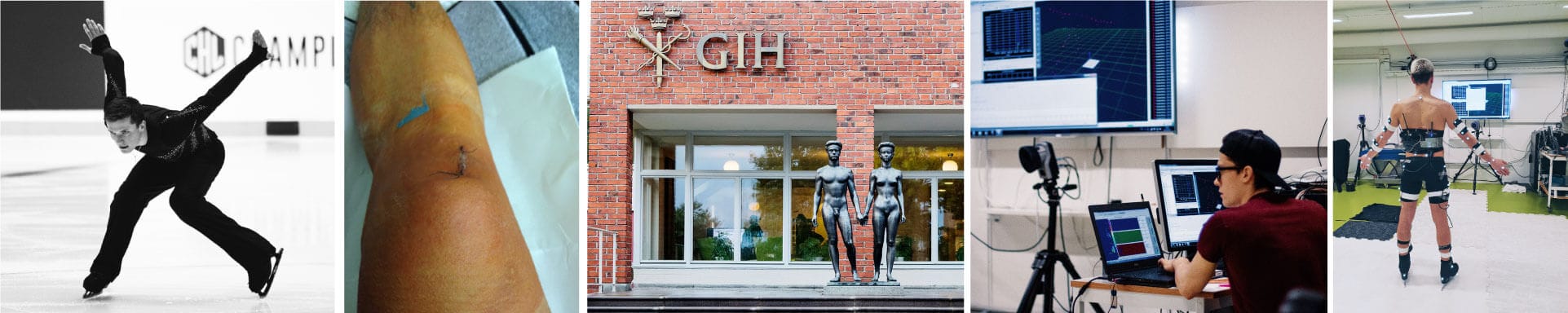 Collage of images showing a figure skater on the ice, a knee injury in figure skating, a university, and a skater in a biomechanical laboratory.