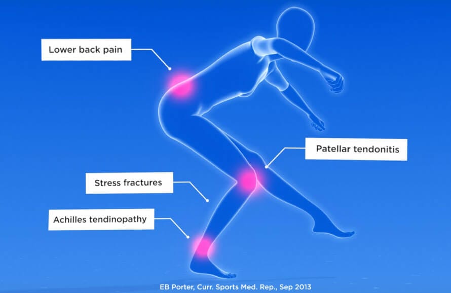 3D model of a skater highlighting the most common figure skating injuries.